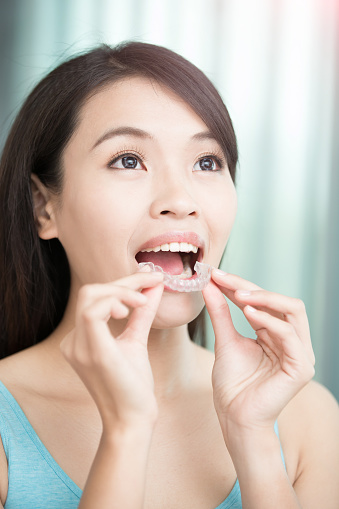 The Invisalign Process